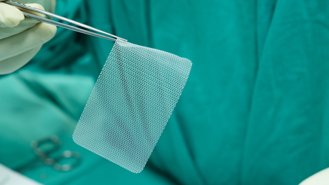 Chirurg hält mit einer Pinzette ein kleines, weißes, netzartiges chirurgisches Implantat Chirurg hält mit einer Pinzette ein kleines, weißes, netzartiges chirurgisches Implantat